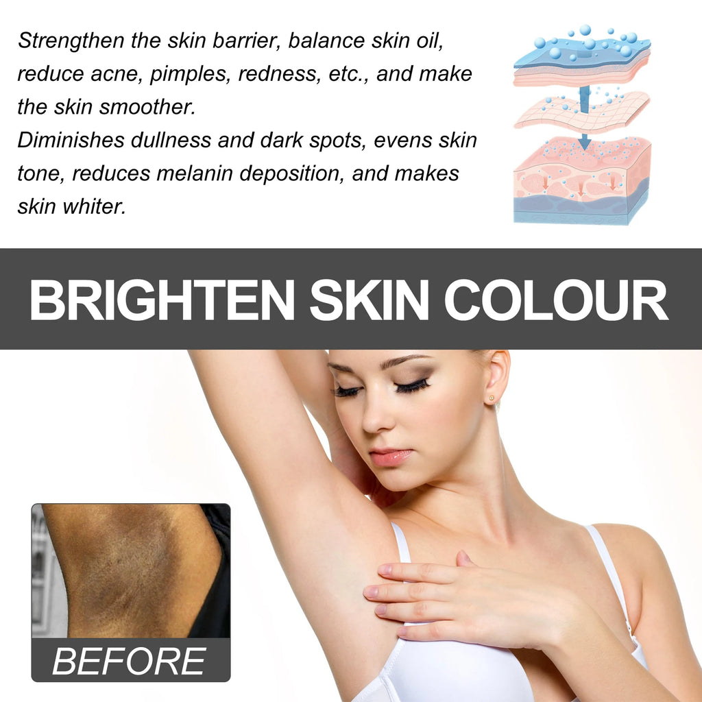 Body Whitening Bleach Cream Brighten Underarm Elbow Knees Joint Removal Intimate Parts Dark Spots Melanin Snow Bleach Cream 30ml