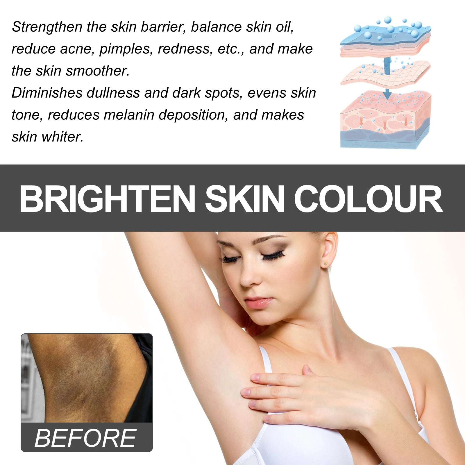 Body Whitening Bleach Cream Brighten Underarm Elbow Knees Joint Removal Intimate Parts Dark Spots Melanin Snow Bleach Cream 30ml