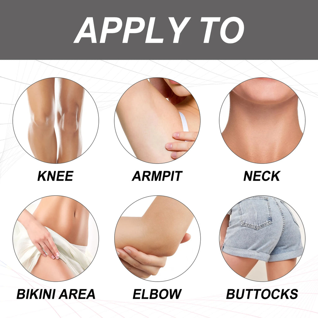 Body Whitening Bleach Cream Brighten Underarm Elbow Knees Joint Removal Intimate Parts Dark Spots Melanin Snow Bleach Cream 30ml